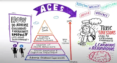 13   ACES   Adverse Childhood Experiences